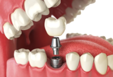 Unlocking the Potential of Dental Biomaterials for Superior Oral Care