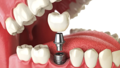 Unlocking the Potential of Dental Biomaterials for Superior Oral Care