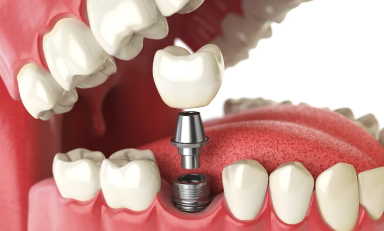 Unlocking the Potential of Dental Biomaterials for Superior Oral Care