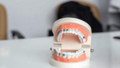 The Hidden Causes of Teeth Crowding and How to Prevent It
