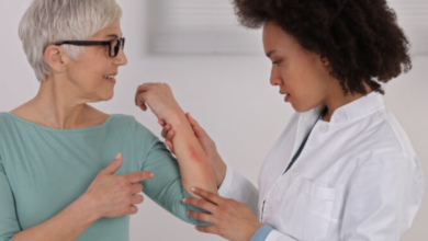 Living with Eczema: Tips for Soothing Irritated Skin