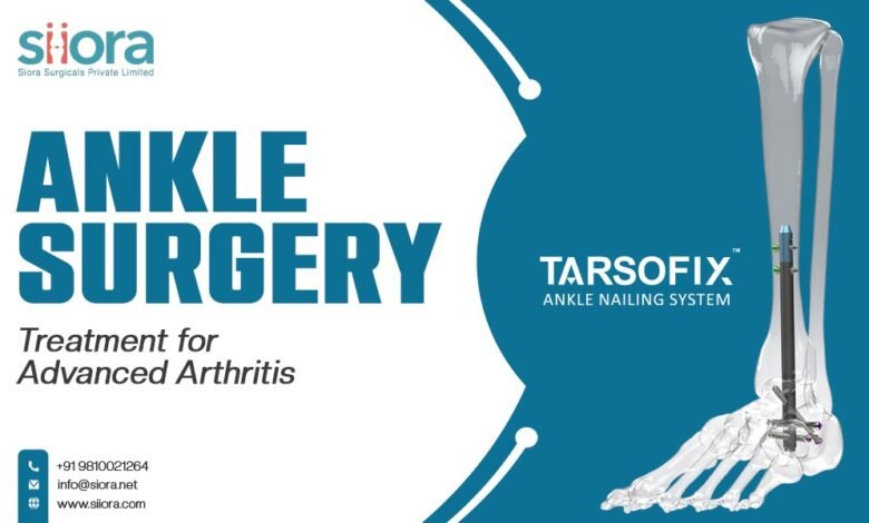 Ankle Surgery: Treatment for Advanced Arthritis